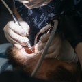 Quando l’intervento del dentista causa danni: cosa dice la legge